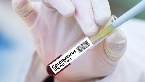 Test de coronavirus en sang. Foto: Gerd Altmann, via Pixabay.